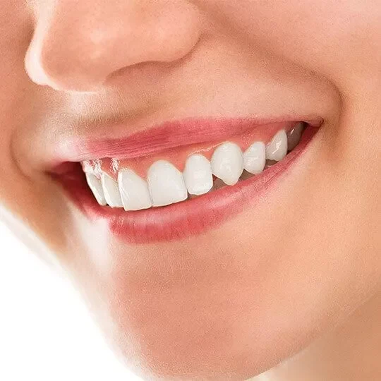 dental-crowns-dubai-1